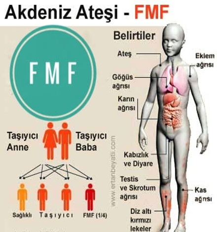 Ailevi Akdeniz Ateşi